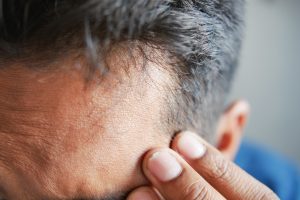 ¿Es normal la caída del cabello? Señales de alerta que debes conocer